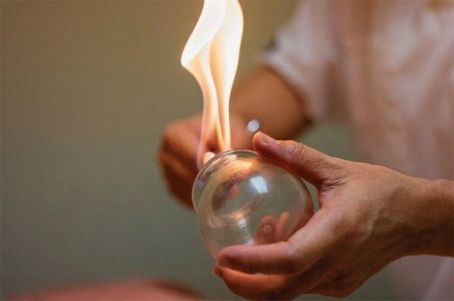 https://acupuncture-sanbao.com/wp-content/uploads/2024/07/cupping-ventouse-flamme-640x424.jpeg